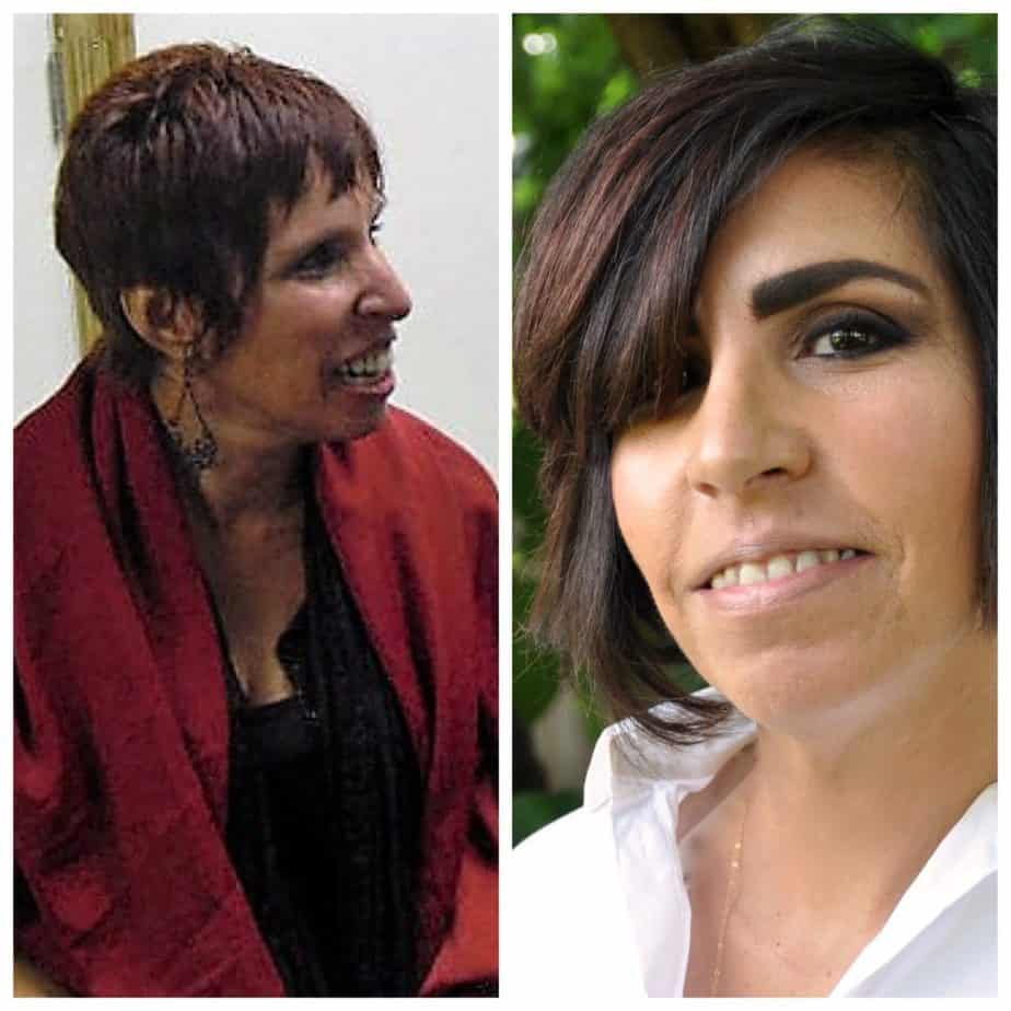 before and after picture Hilda Solares